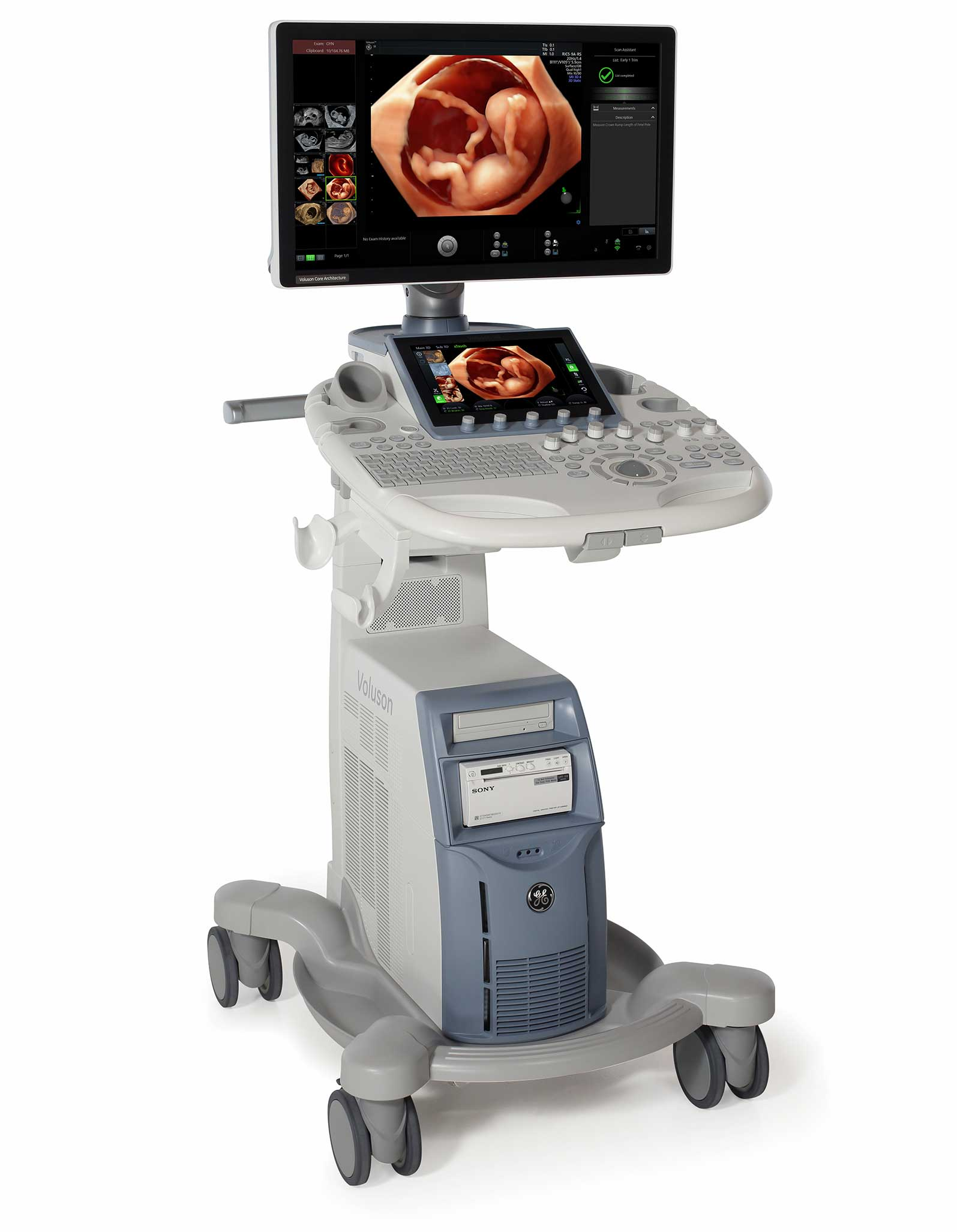 GE Voluson S8 TOUCH – For Gynecology