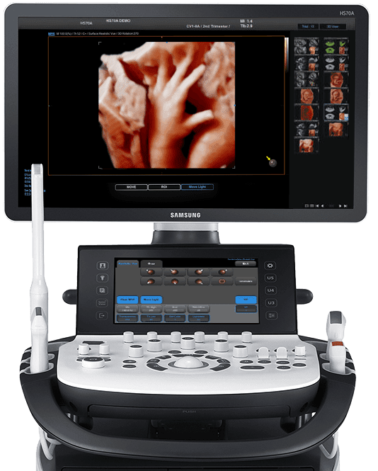 POWERFUL 3D ANATOMY ULTRASOUND HS70A with Prime